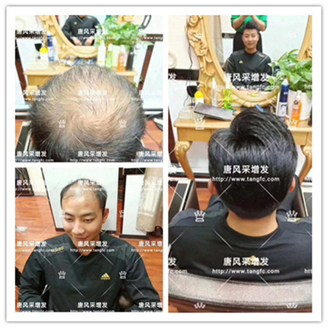 物理增發(fā)能維持多久 唐風(fēng)采客戶案例