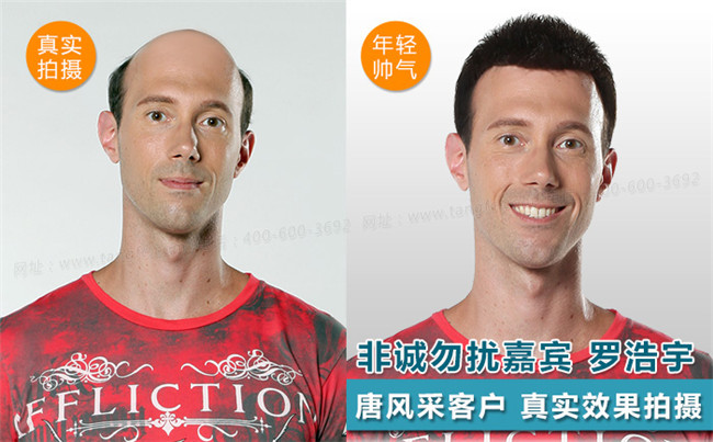 禿頂發(fā)型設(shè)計 唐風(fēng)采客戶