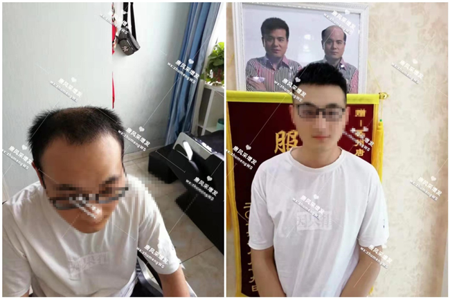 頭頂局部假發(fā) 唐風(fēng)采假發(fā)可以戴著打球和游泳