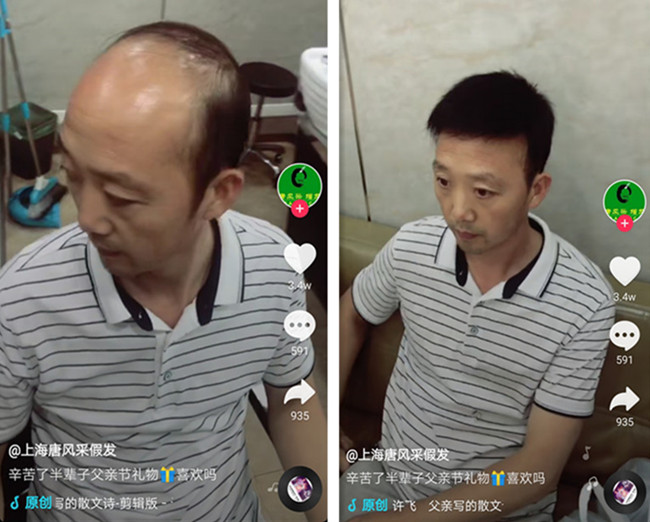 頭頂局部假發(fā) 唐風(fēng)采客戶案例