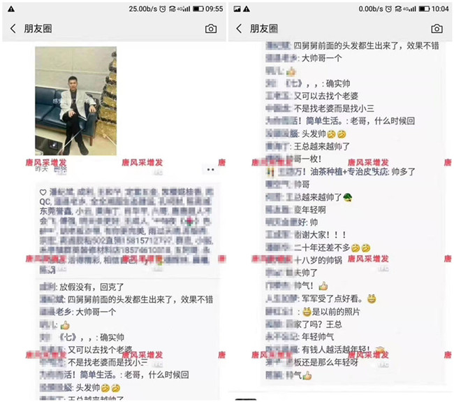 補(bǔ)發(fā)織發(fā)效果如何 王先生的朋友圈