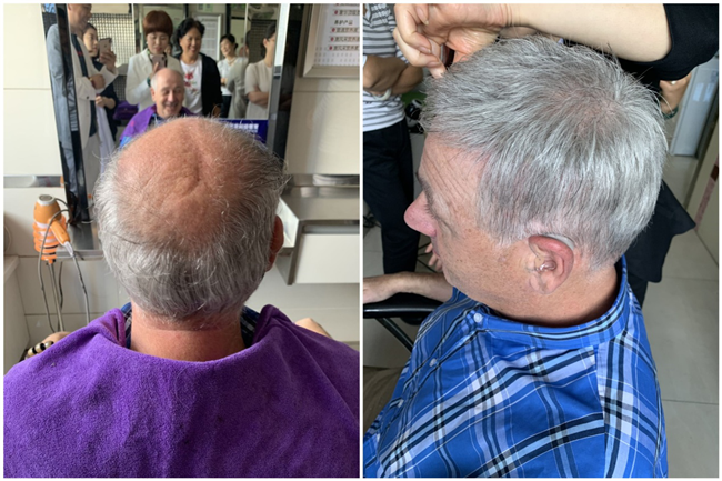 無(wú)痕補(bǔ)發(fā)哪家好 外國(guó)人也到唐風(fēng)采補(bǔ)發(fā)