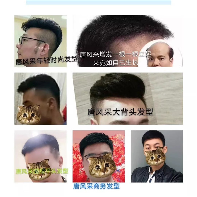 唐風(fēng)采福州店 真實(shí)客戶案例分享篇照