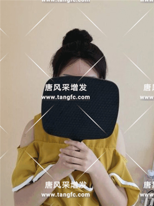 丸子頭發(fā)際線 丸子頭導致發(fā)際線越來越高