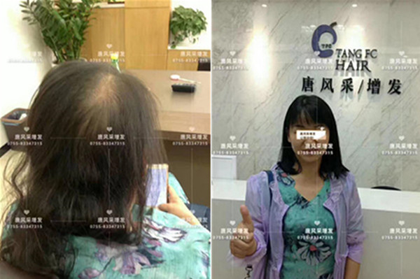 買假發(fā)哪個(gè)牌子好又便宜 唐風(fēng)采客戶案例