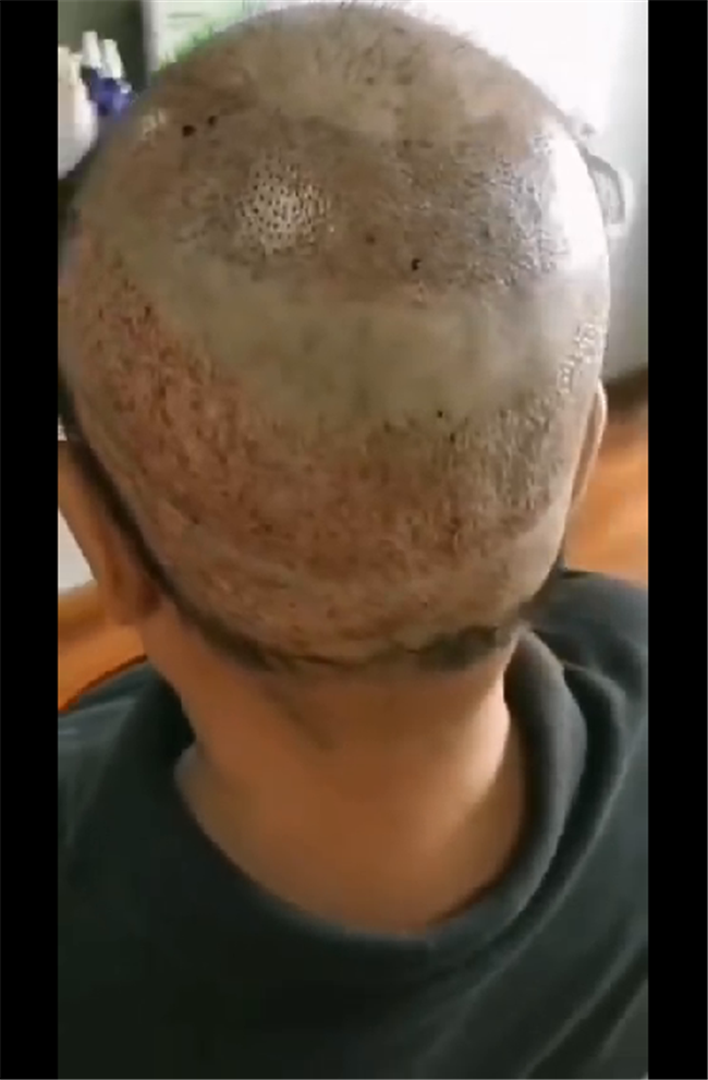 仿真頭皮假發(fā)價(jià)格 唐風(fēng)采客戶王先生