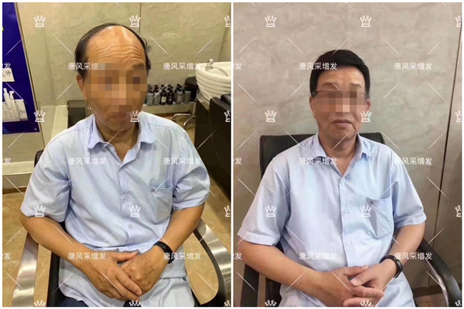 老年人透氣假發(fā) 唐風(fēng)采客戶案例