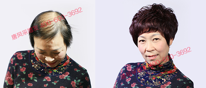 中老年頭發(fā)少 短發(fā)燙卷會(huì)更有蓬松感