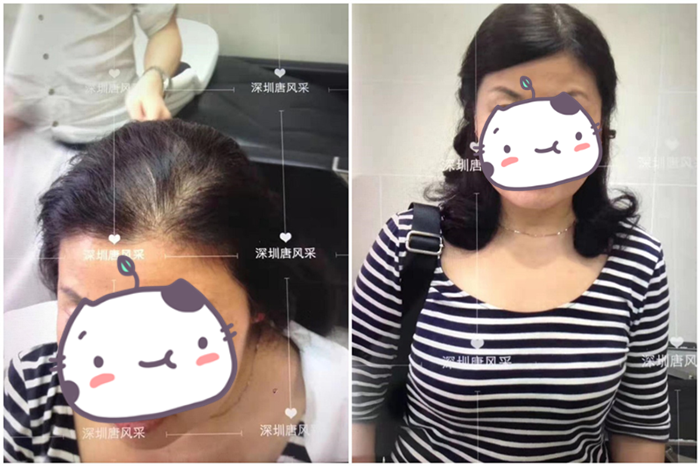 中老年女士假發(fā) 唐風采客戶案例圖