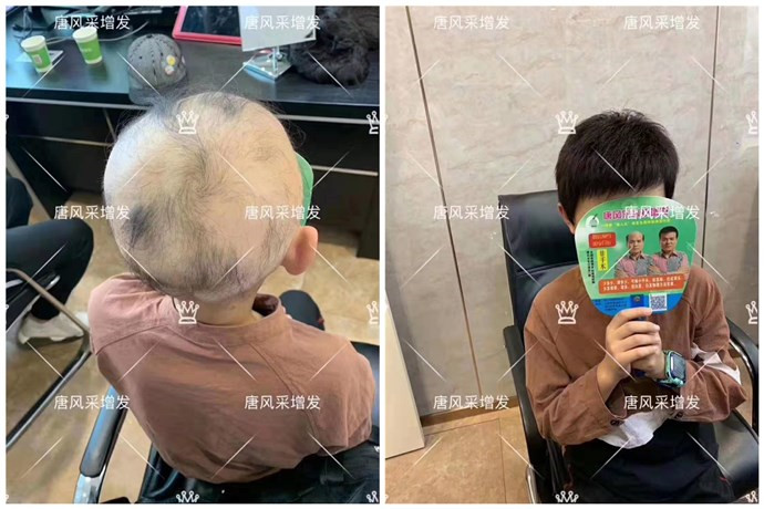 假發(fā)頭套 可以選擇到唐風(fēng)采購(gòu)買(mǎi)假發(fā)