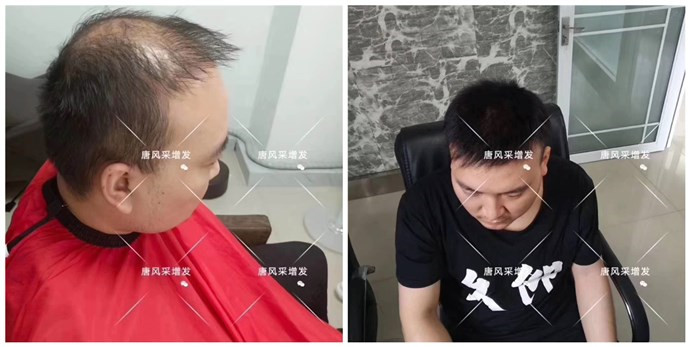 男老年假發(fā)套 唐風(fēng)采客戶(hù)案例