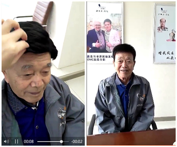 真發(fā)假發(fā)套的價(jià)格 唐風(fēng)采客戶(hù)戴假發(fā)前后對(duì)比