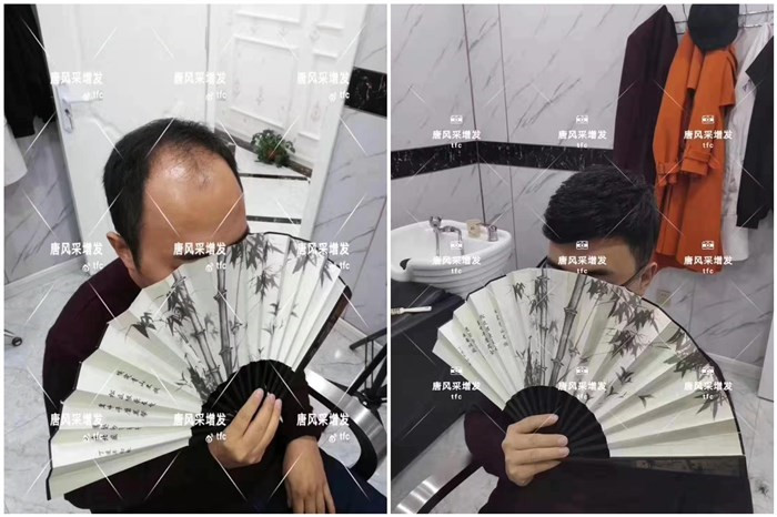 短假發(fā)需要多少錢(qián) 唐風(fēng)采客戶案例