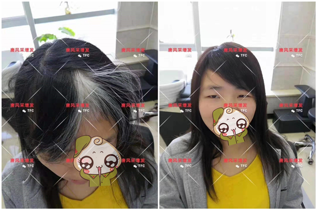 遮蓋白發(fā)的假發(fā)片 唐風(fēng)采客戶案例