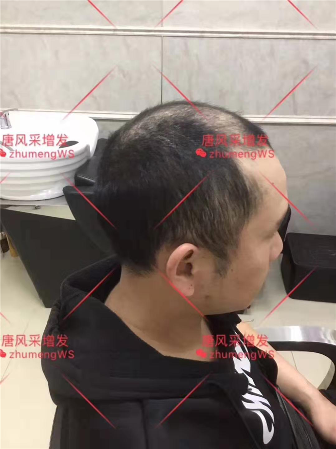 時尚個性假發(fā) 唐風(fēng)采客戶增發(fā)前