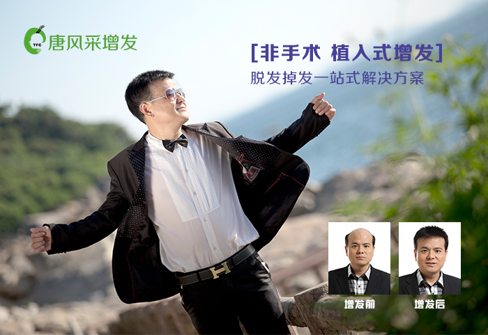 隱形發(fā)套 歡迎來電咨詢