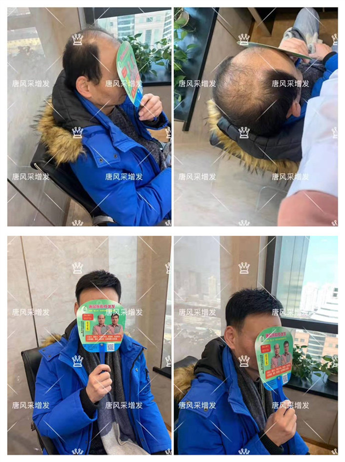 可以洗的假發(fā) 唐風(fēng)采客戶案例