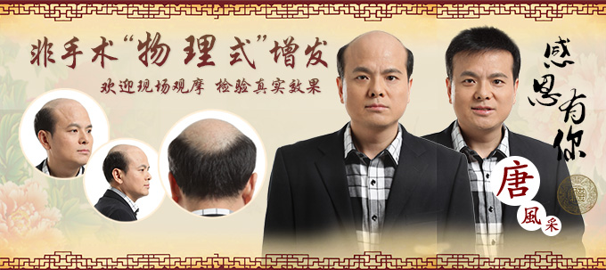 假發(fā)要多少錢 唐風采定制假發(fā)