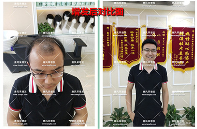 抖音假發(fā) 唐風采客戶案例