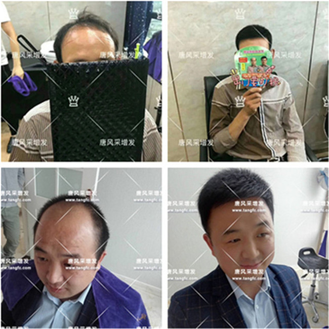 一個假發(fā)能用多久, 專業(yè)假發(fā)專賣店會提供護(hù)養(yǎng)服務(wù)