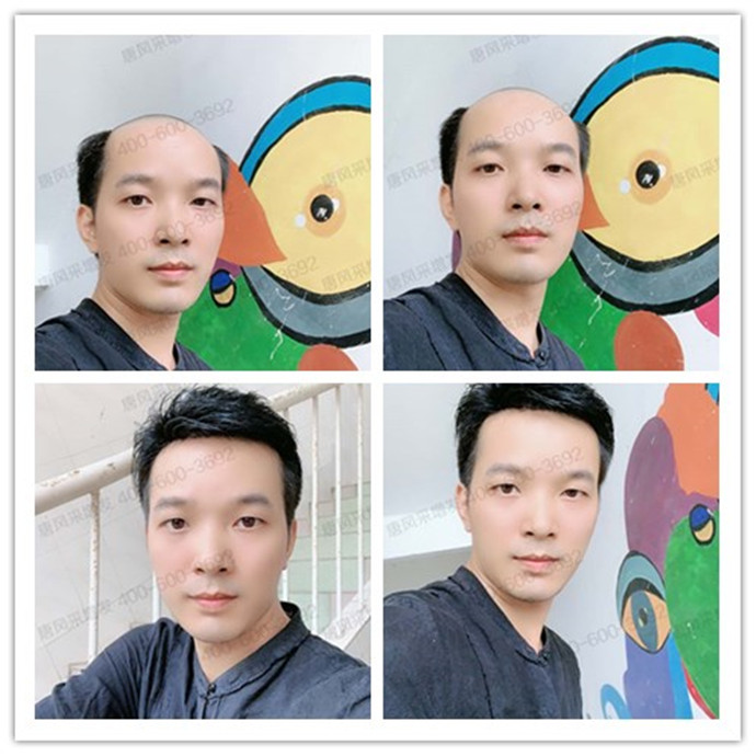 網上賣的纖維發(fā)絲不夠逼真