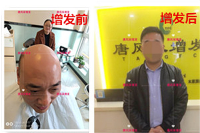 光頭男士可以帶頭套嗎 \