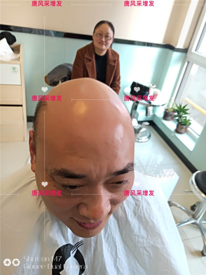 男士光頭假發(fā) \