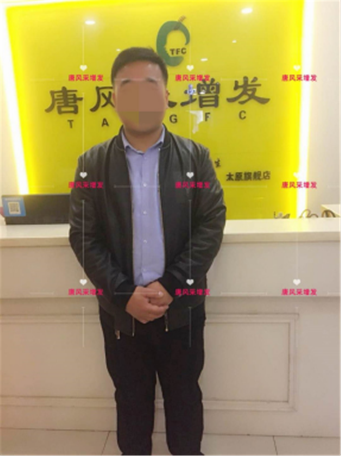 假發(fā)戴了會掉嗎 \