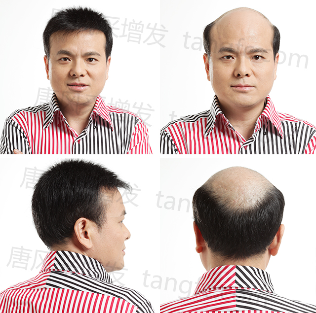 男士光頭假發(fā) \