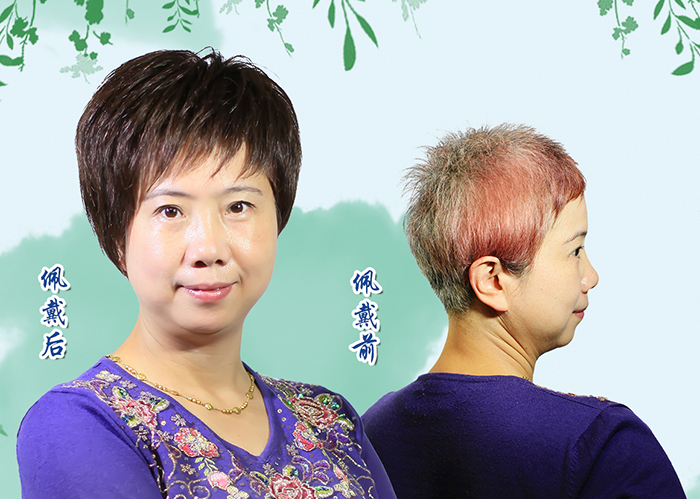 染發(fā)好還是戴假發(fā)好 \