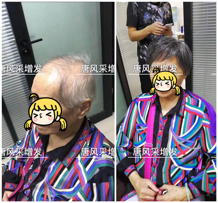 染發(fā)好還是戴假發(fā)好 \