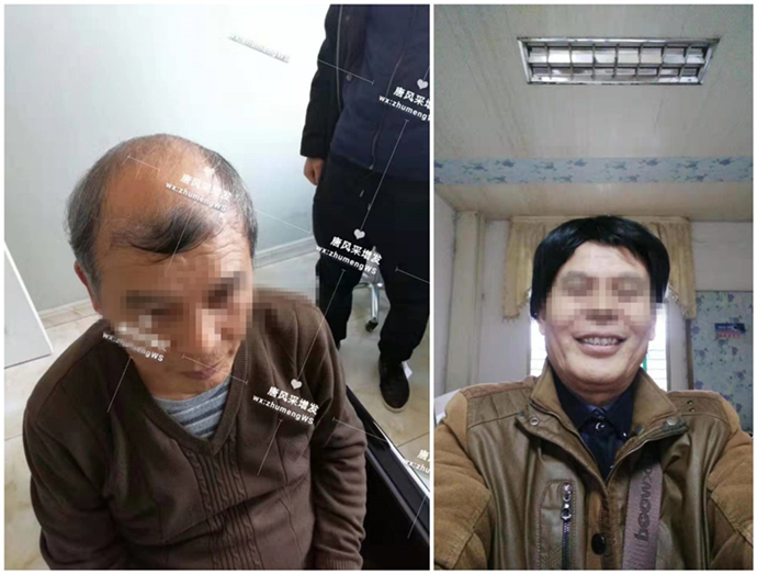 買假發(fā)選哪個品牌 \