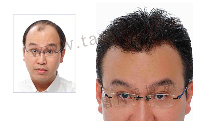 假發(fā)選哪個品牌好 \