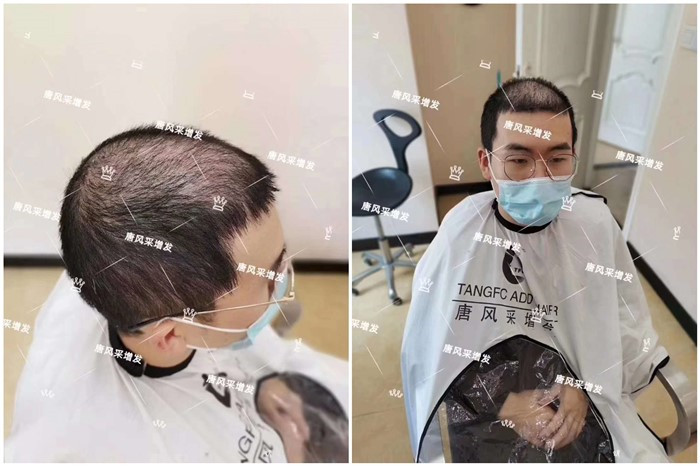 真發(fā)發(fā)片 \