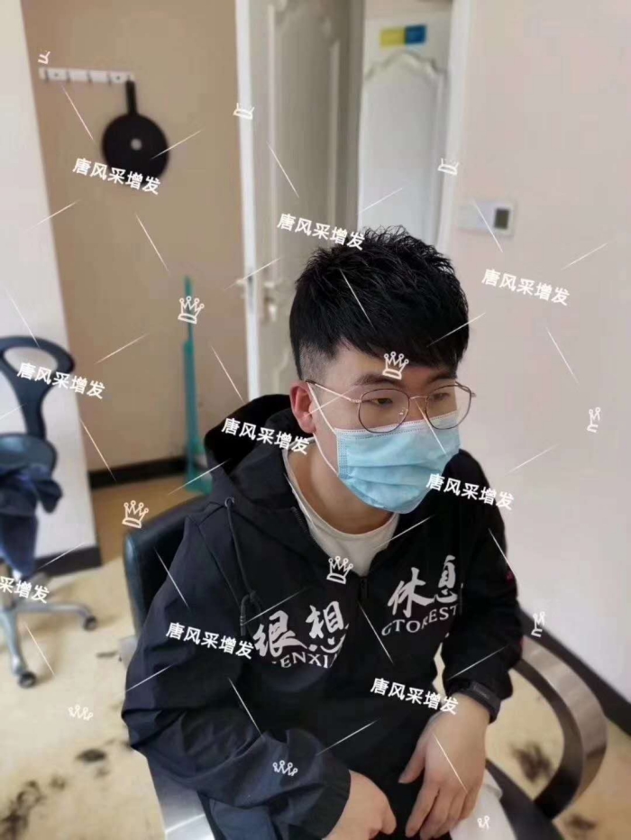 發(fā)片佩戴效果 \