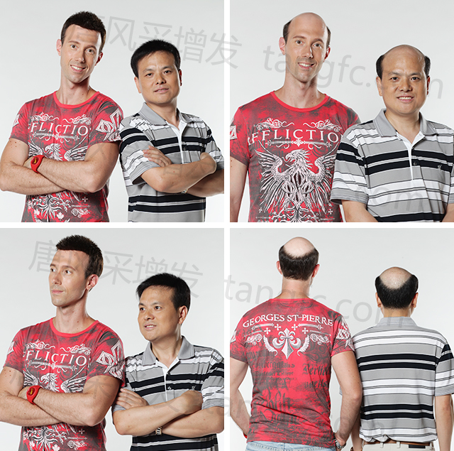 真發(fā)發(fā)片 \