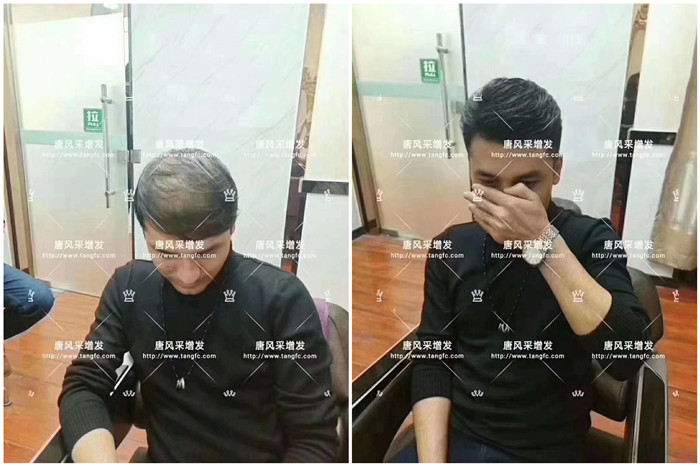 發(fā)片佩戴效果 \