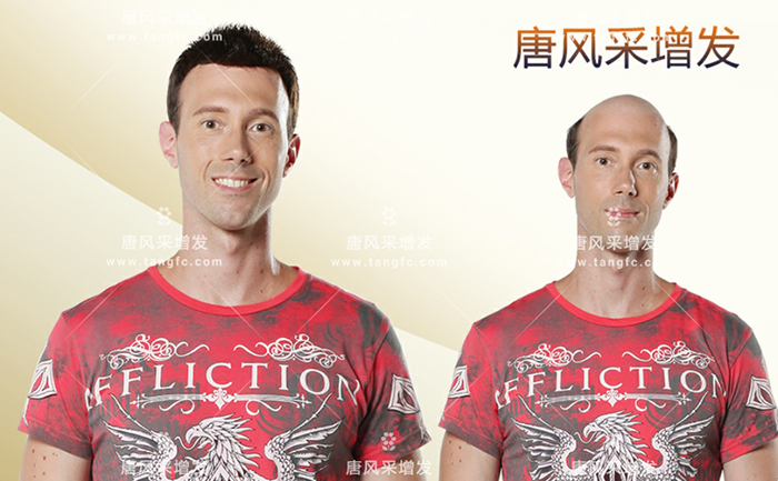 如何購買假發(fā) \