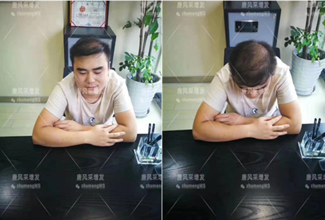 如何購買假發(fā) \