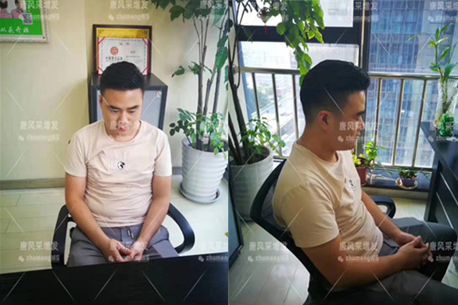 如何購買假發(fā) \