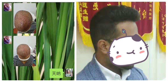 怎么戴才夠自然 \