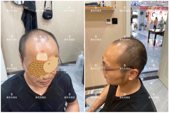 男士假發(fā)片 \