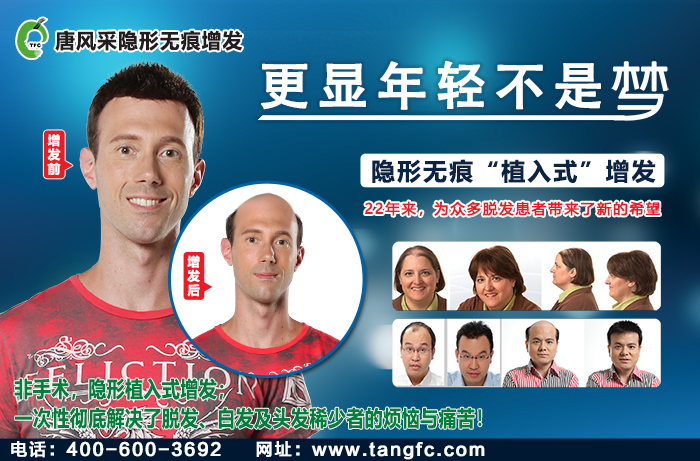 假發(fā)無(wú)痕發(fā)際線 \