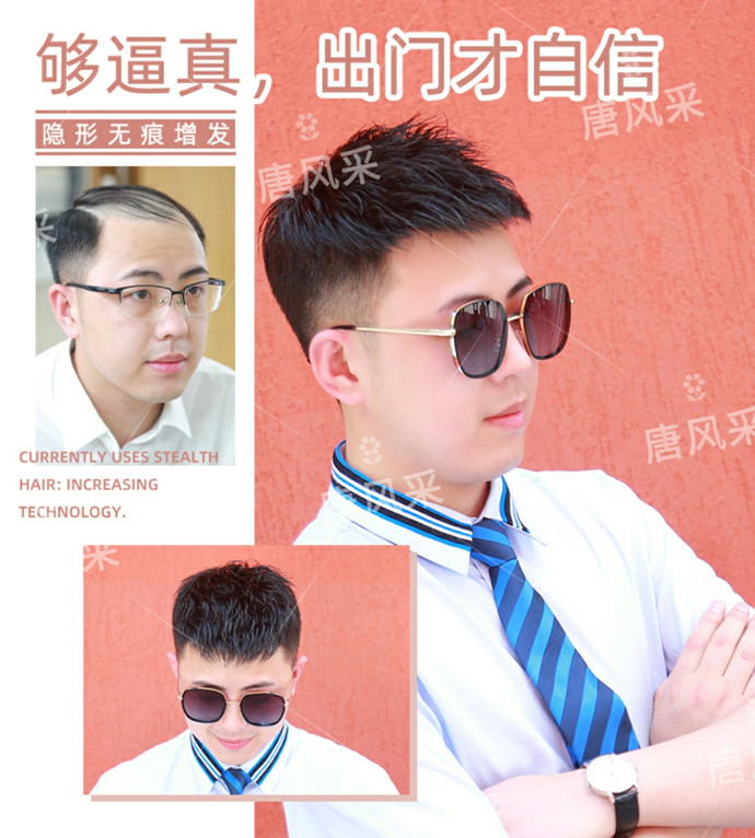 假發(fā)無(wú)痕發(fā)際線 \