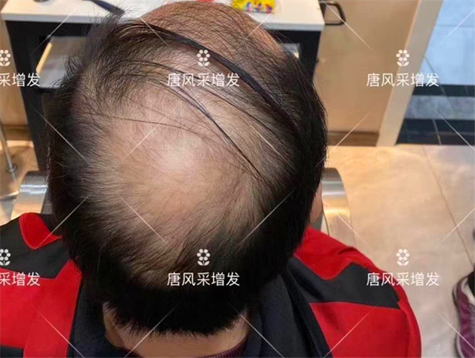 中年男士假發(fā) \