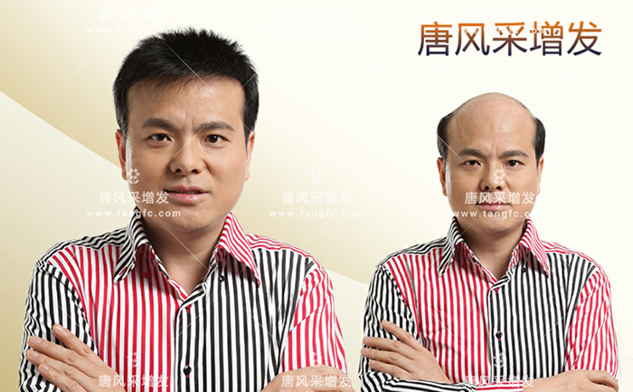 補(bǔ)發(fā)增發(fā) \