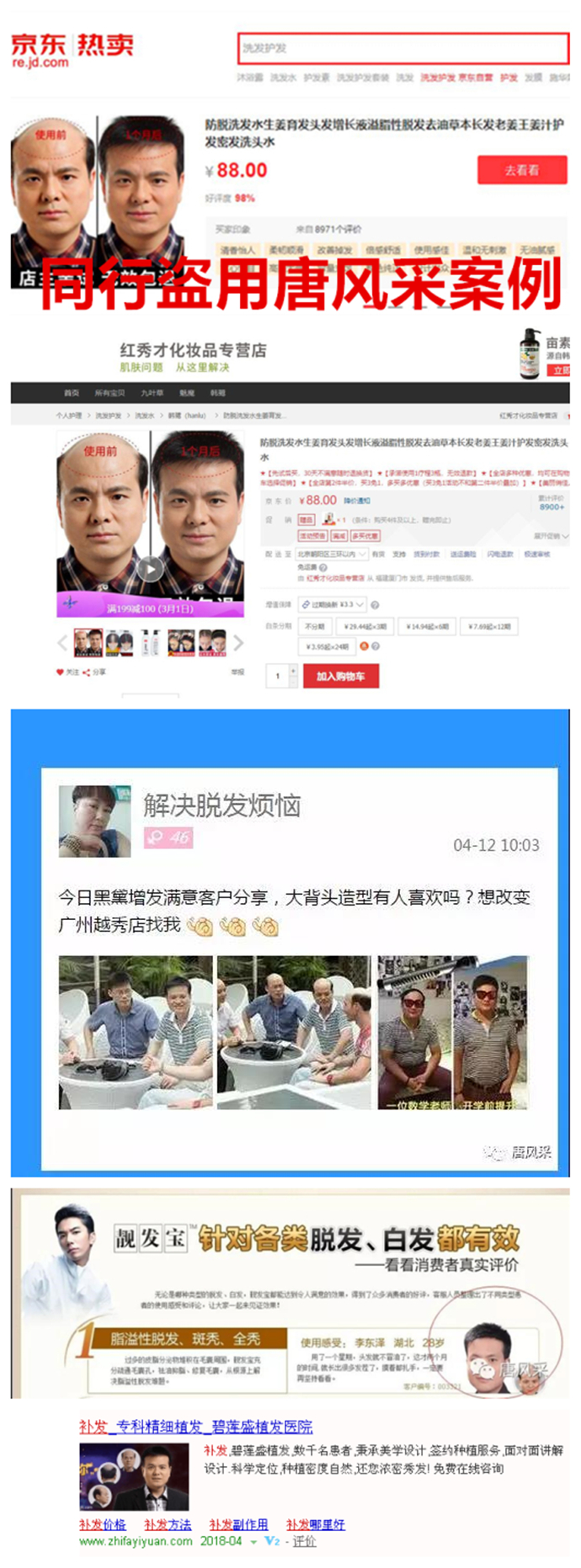 頭發(fā)少做織發(fā)補發(fā) \