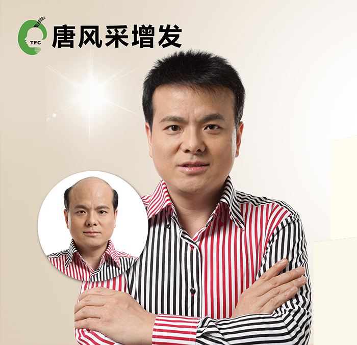 頭發(fā)少做織發(fā)補發(fā) \