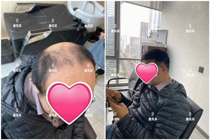 看臉型定做假發(fā) \