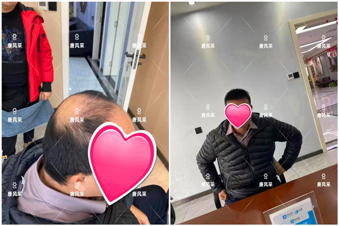 看臉型定做假發(fā) \